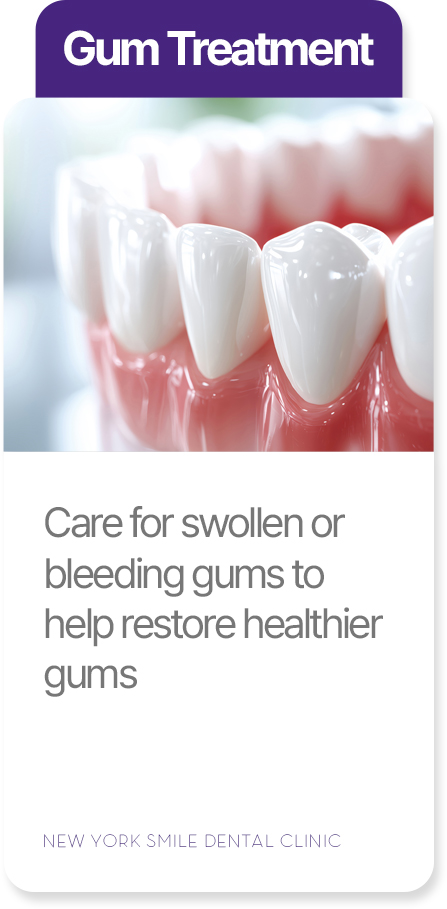 Gum treatment at New York Smile Dental Clinic