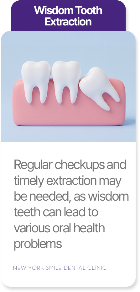 Wisdom tooth extraction at New York Smile Dental Clinic