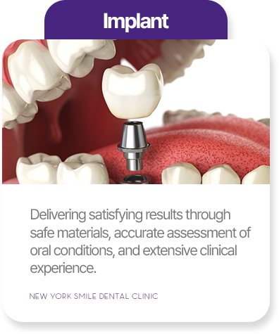 Implant treatment at New York Smile Dental Clinic