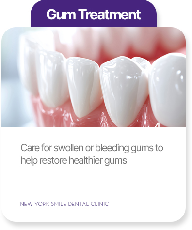 Gum treatment at New York Smile Dental Clinic
