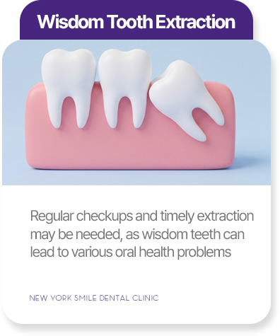 Wisdom tooth extraction at New York Smile Dental Clinic