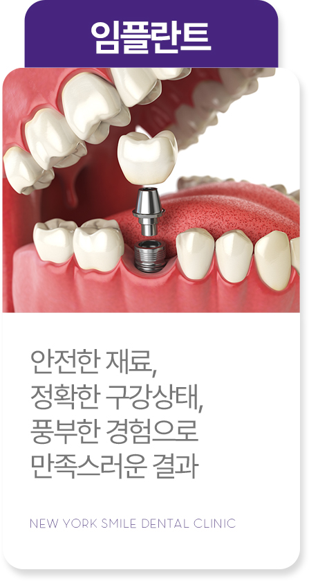 보존치료 보존치료