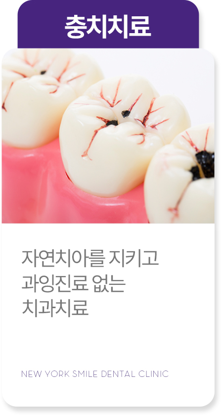 보철치료 보철치료