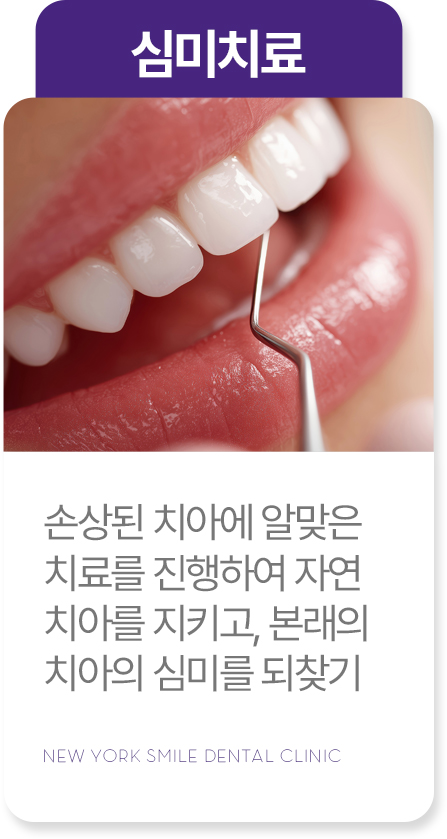 임플란트 임플란트