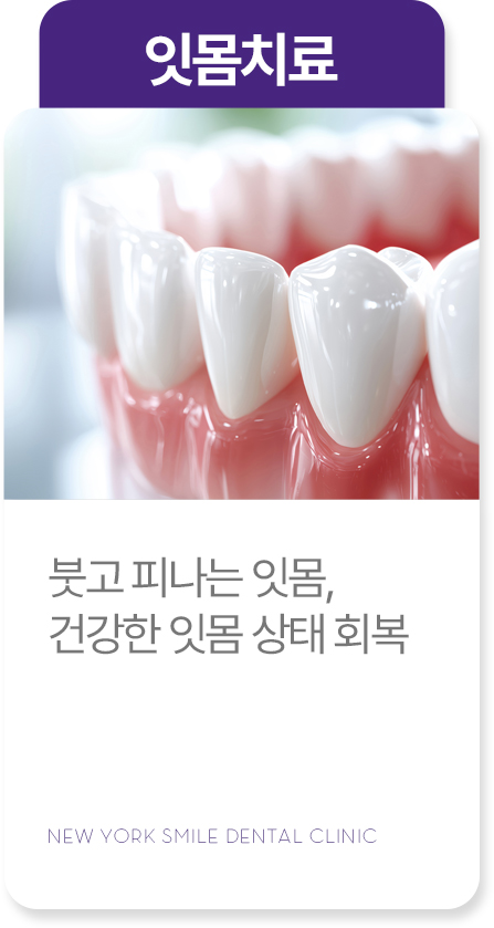 충치치료 충치치료