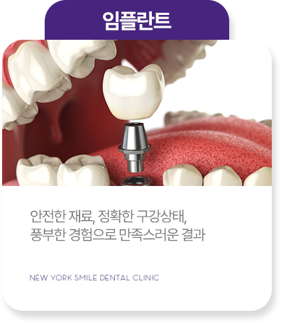 보존치료 보존치료