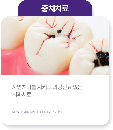 보철치료 보철치료