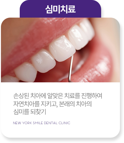 임플란트 임플란트