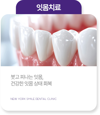 충치치료 충치치료